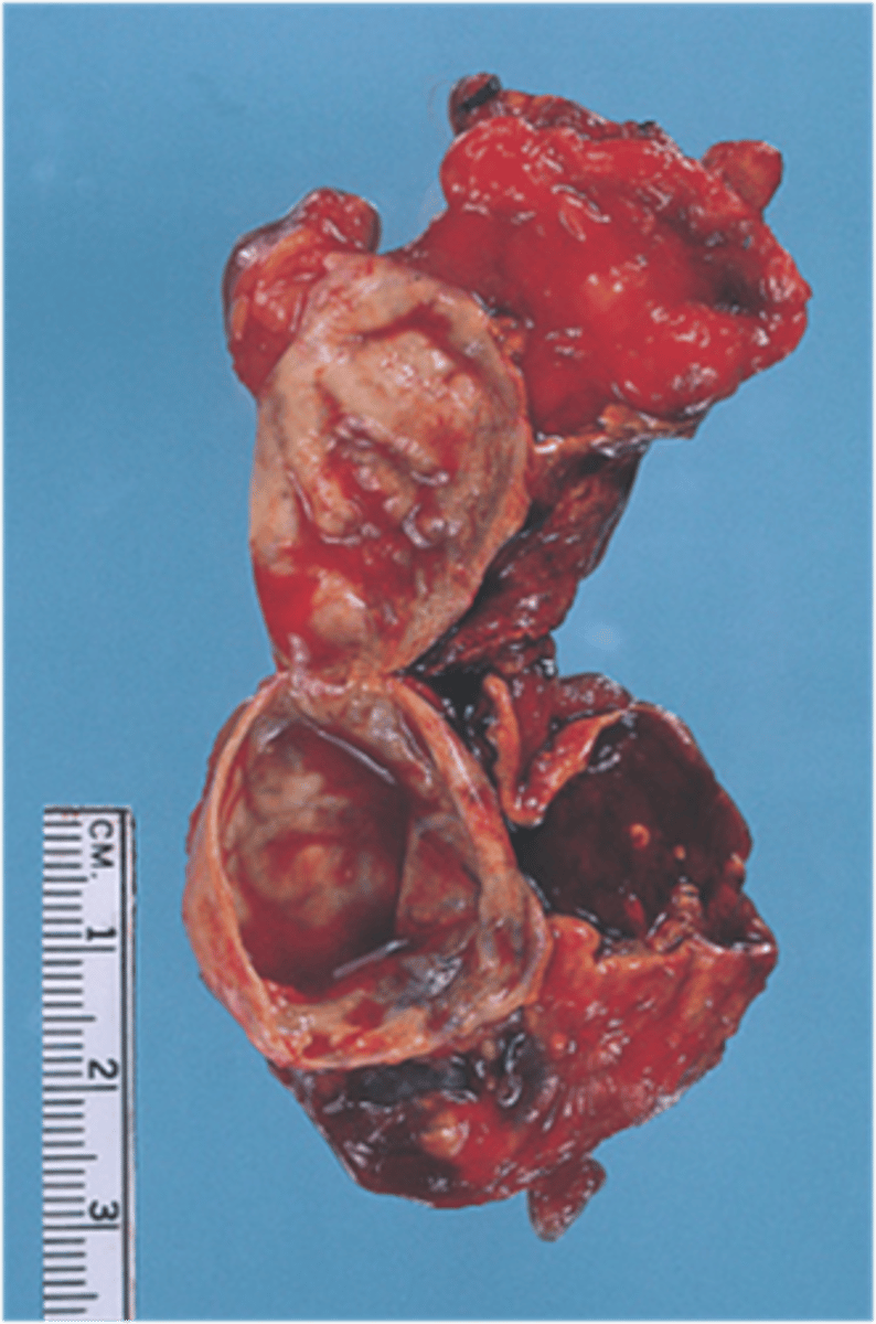 <p>Identify the pathology</p>