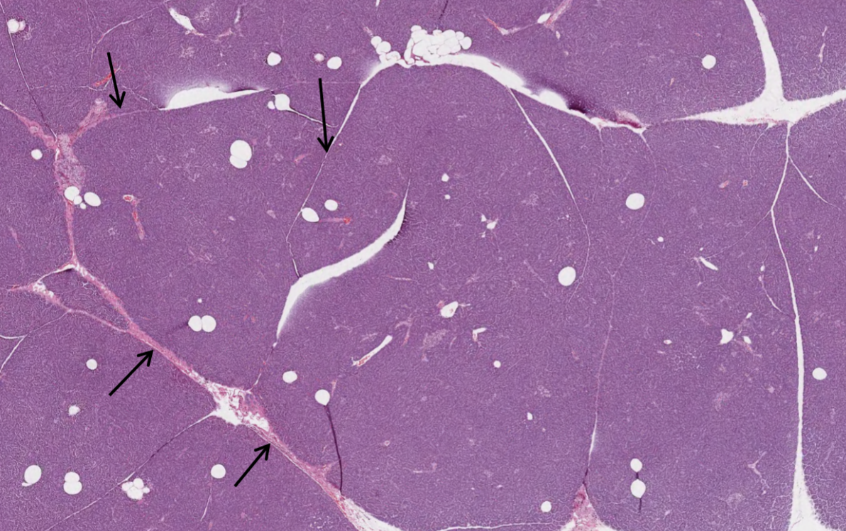 <p>what do the arrows in this image of a pancreas indicate?</p>