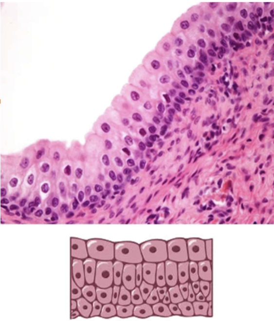 <p>Stratified Cuboidal epithelium but changes dramatically with distention of the underlying tissues  </p><p>Located in: Bladder and parts of urinary tract </p><p></p>