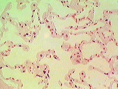 <p>Alveoli</p>