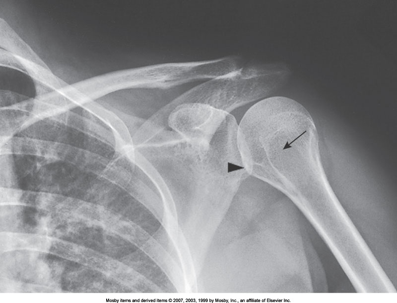 <p>What position is demonstrated?</p>