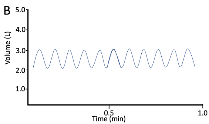 <p>B</p>