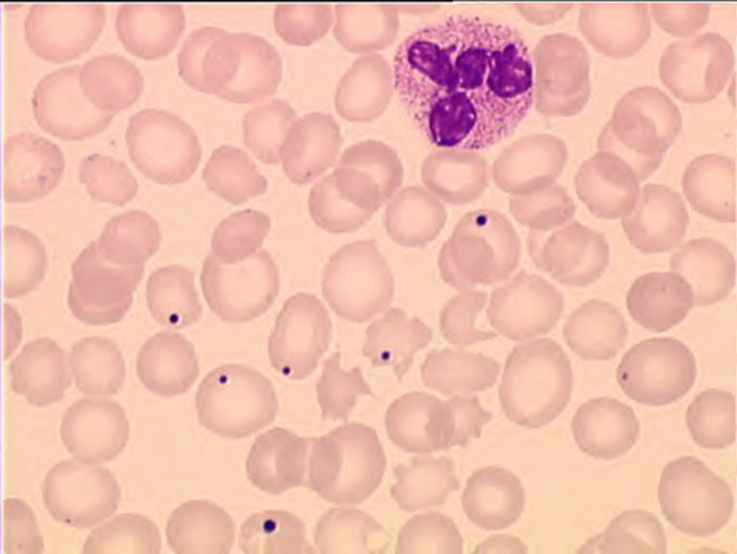 <p>round dense staining inclusions, usually toward one edge of the cell; represents a nuclear fragment</p><p>(RBC inclusions)</p>