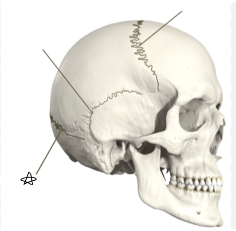 <p>what suture is the star pointing to </p>