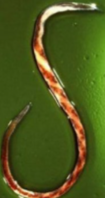 <p>What is this parasite and its clinical signs? Diagnostic tests?</p>