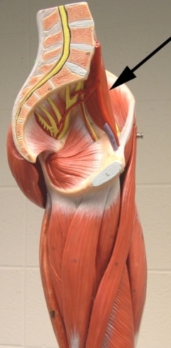 <p>Name the muscle group indicated by the arrow</p><p>VIEW: medial side of the thigh</p>