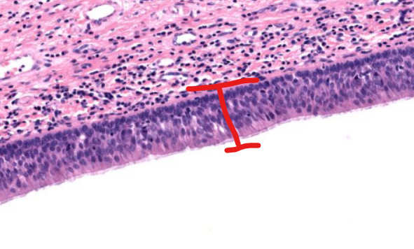 <p>tissue type (on epiglottis)</p>