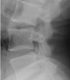 <p>Q what position is the spine in here?</p>