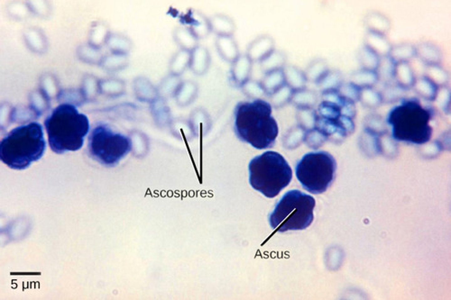 <p>Ascomycota</p>