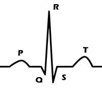 <p>P wave: atrial depolarization </p><p>QRS: Ventricular depolarization </p><p>T: Ventricular repolarization </p>