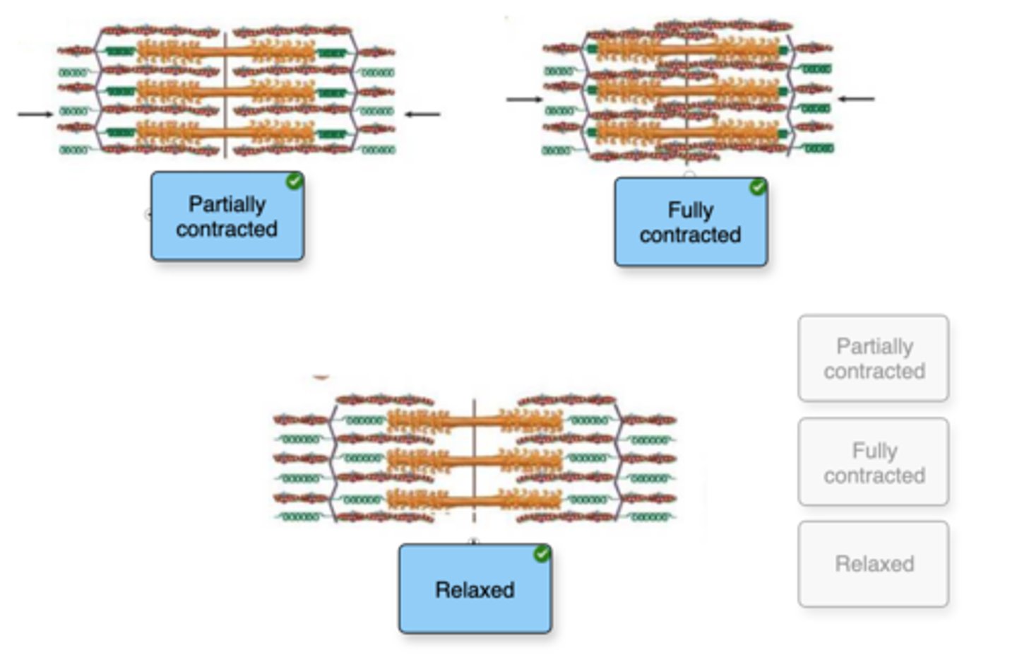 <p>The H zone and I band disappear, and the sarcomere is at its shortest length.</p>