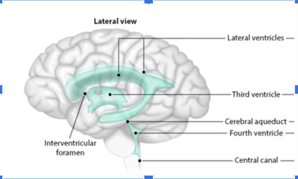 <p>Trace CSF flow from Ventricles to Fourth Ventricle</p>
