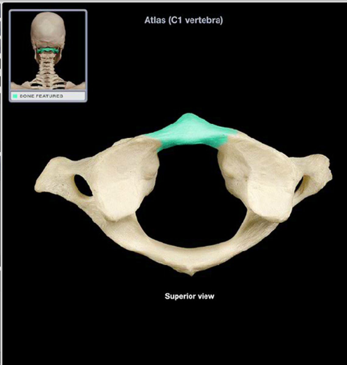<p>A small arch on the atlas that would be in the ventral most part of the body. Allows for a ventral articulation with the Dens.</p>