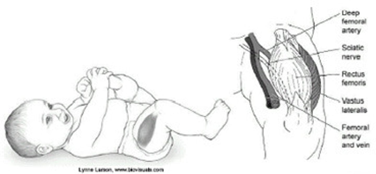 <p>intramuscular</p>