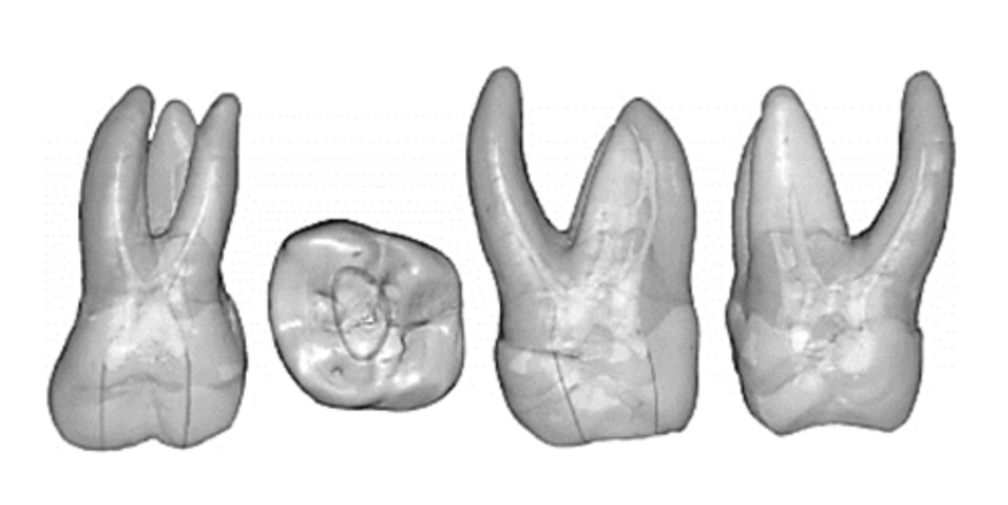 <p>3: palatal, MB, DB</p>