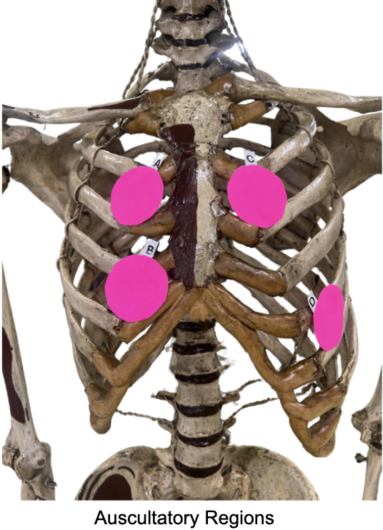 <p>Where to place the pad of the stethoscopes in the patient's precordium, if you want to assess the integrity and status of: Mitral valve</p>