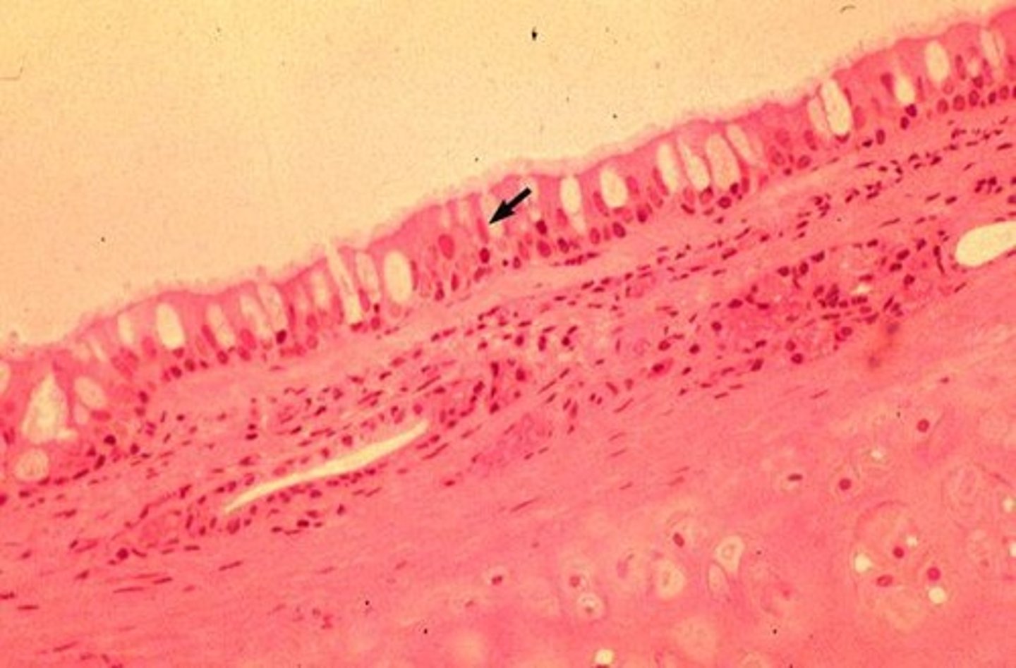 <p>They produce mucus to trap foreign particles and pathogens.</p>