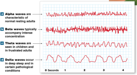 <ul><li><p>Measures overall brain activity using electrodes placed on the head</p></li><li><p>Measures frequency and amplitude of brain waves.</p></li></ul>