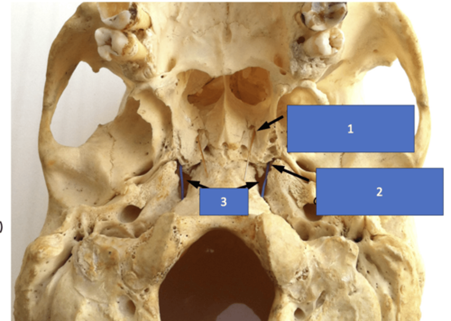 <p>Identify the structure at #2</p>