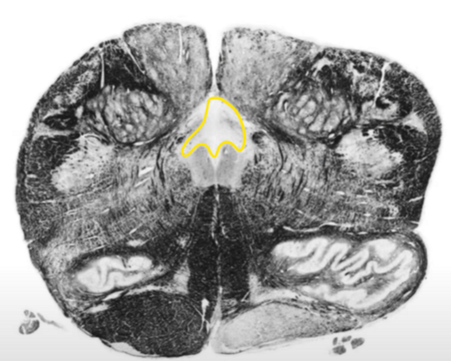 <p>ID the structure</p>