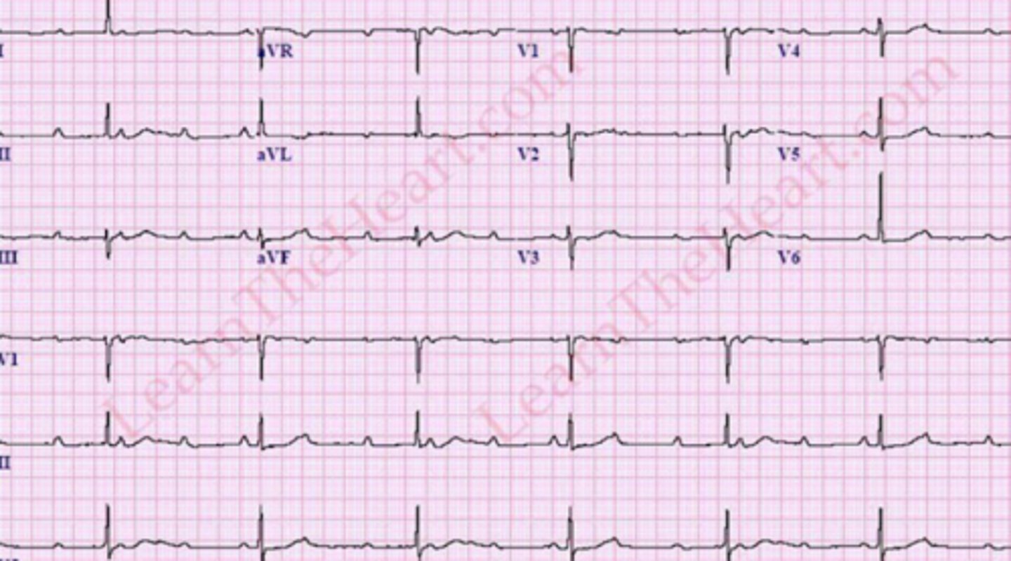 <p>What are the findings</p>