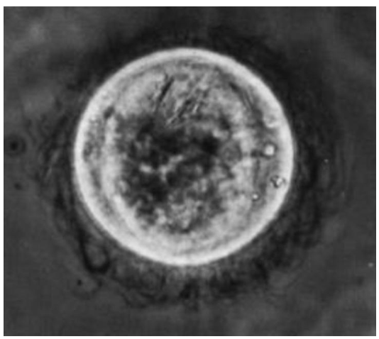 <p>Spp</p><p>stage</p>