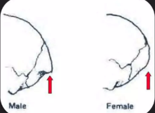 <p>male- more prominent; females- less prominent</p>