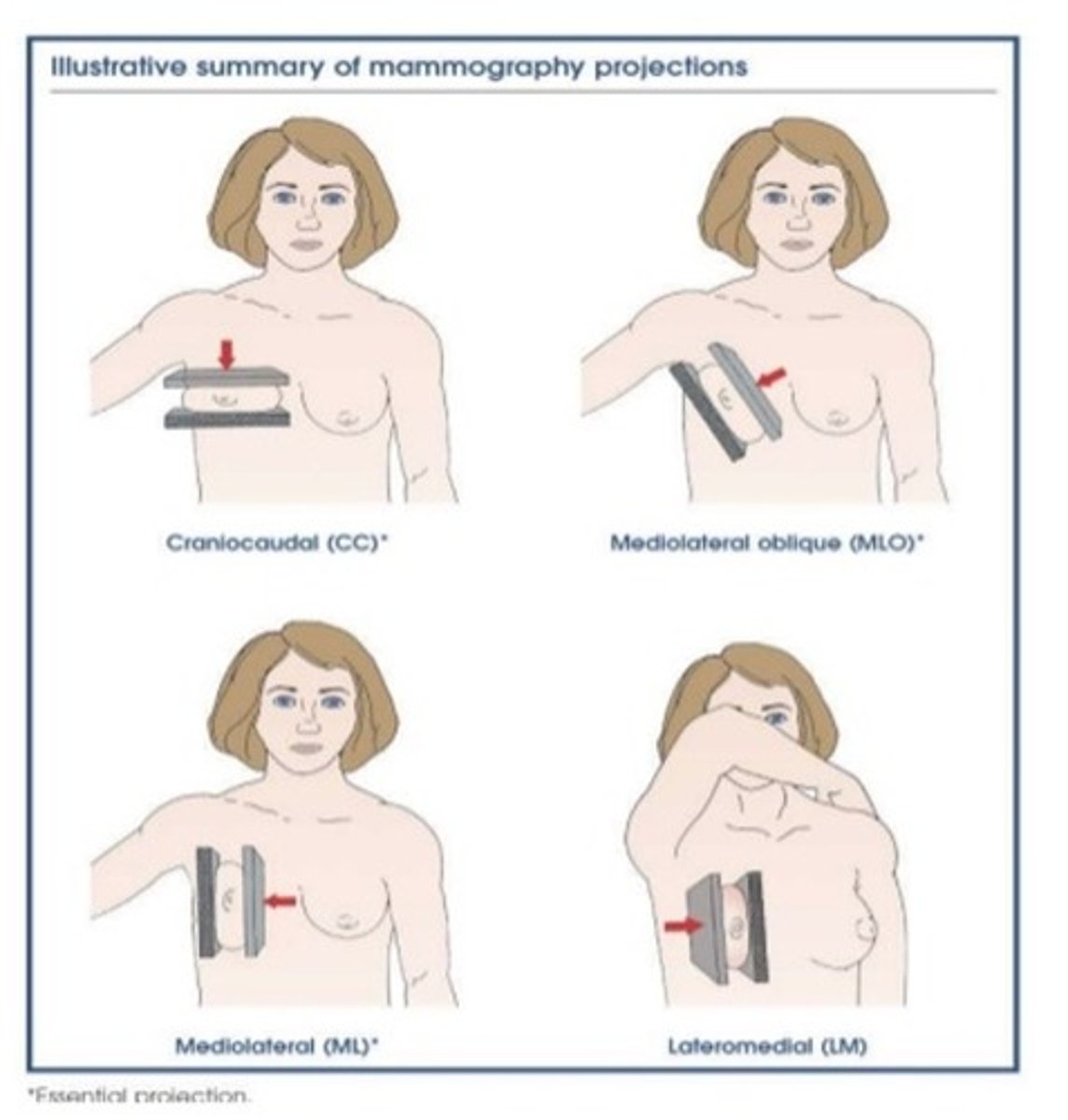 <p>When might a DIAGNOSTIC Mammogram be done instead of a Screening Mammogram?</p><p>Describe what is done</p>