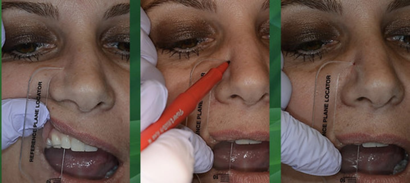 <p>this is a point that helps you find the transverse hinge axis based on what the average position of it is in most humans, usually infraorbital notch or another facial landmark (43mm above #7 incisal edge in humans)</p>