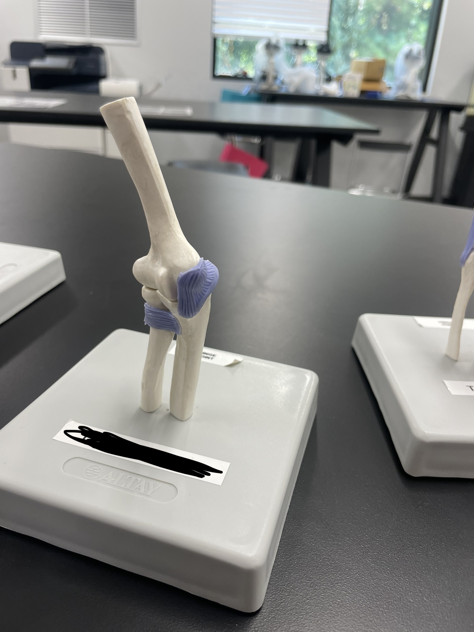 What type of joint is this 