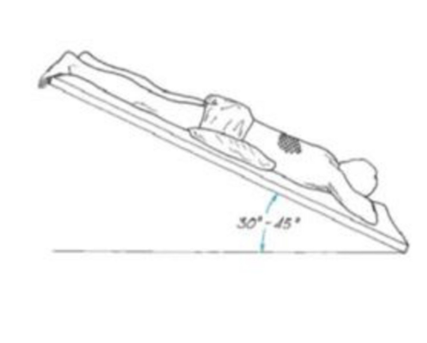 <p>patient lies prone, pillows under the abdomen, in a 45 degree head-down position; percussion is applied bilaterally over the lower portion of the ribs</p>