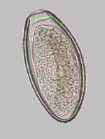 <p><em>Oxyuroidea equi</em></p><p></p><ul><li><p>Nematode</p></li><li><p>Asymmetrical, operculated/plugged, non-larvated eggs</p></li></ul><p></p>