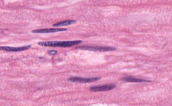 <p>elongated nuclei located in the endoneurium</p>