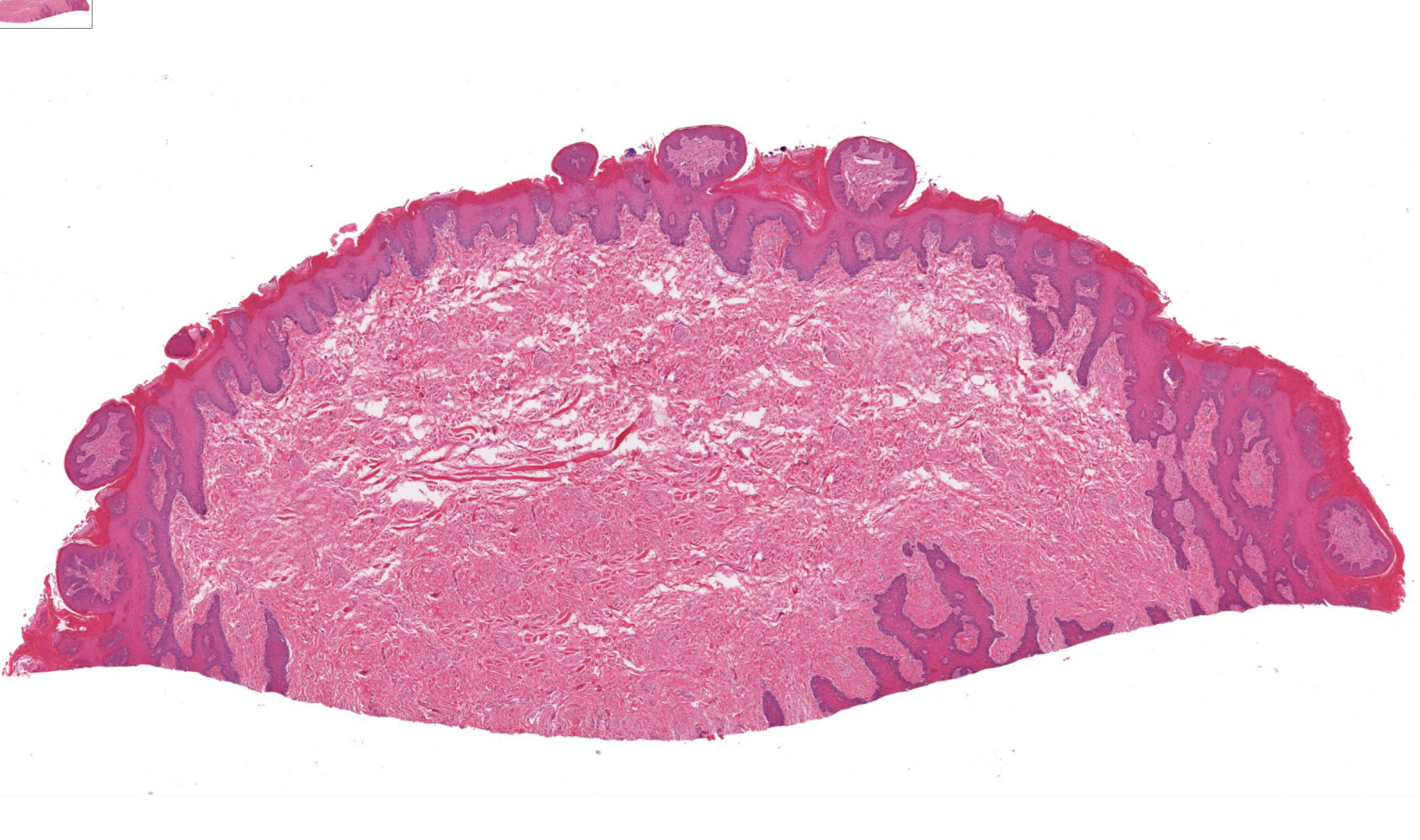 <p>Organ?</p>