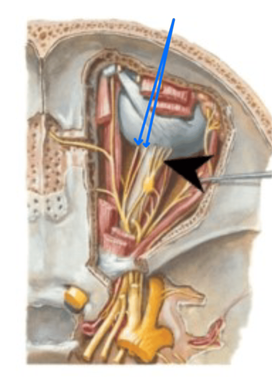 <p>What is this blue arrow pointing to?</p>