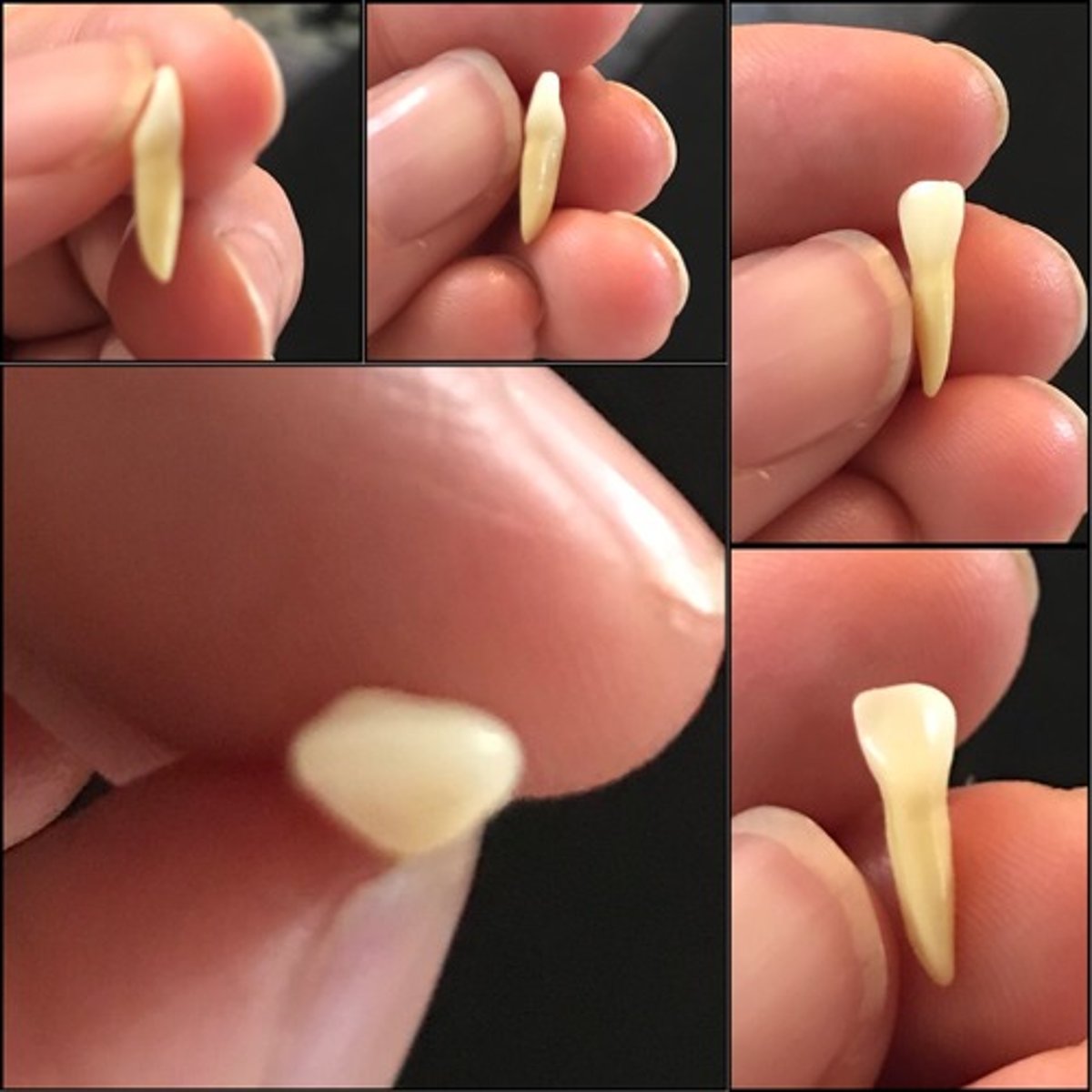 <p>What tooth is this ?</p>