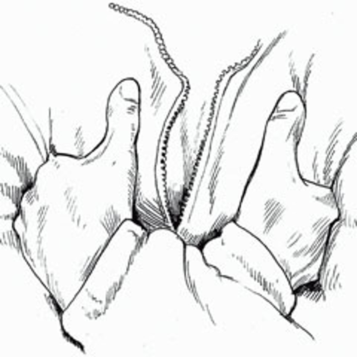 <p>do not rub; remove wet or tight clothing; cover with dry, sterile dressing; warm the area slowly with warm, not hot water</p>