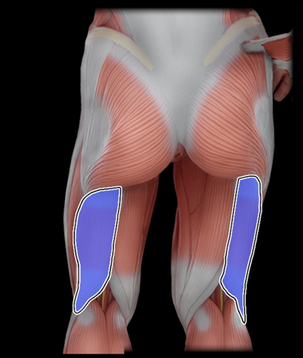 <p>What Muscle Is Highlighted?</p>