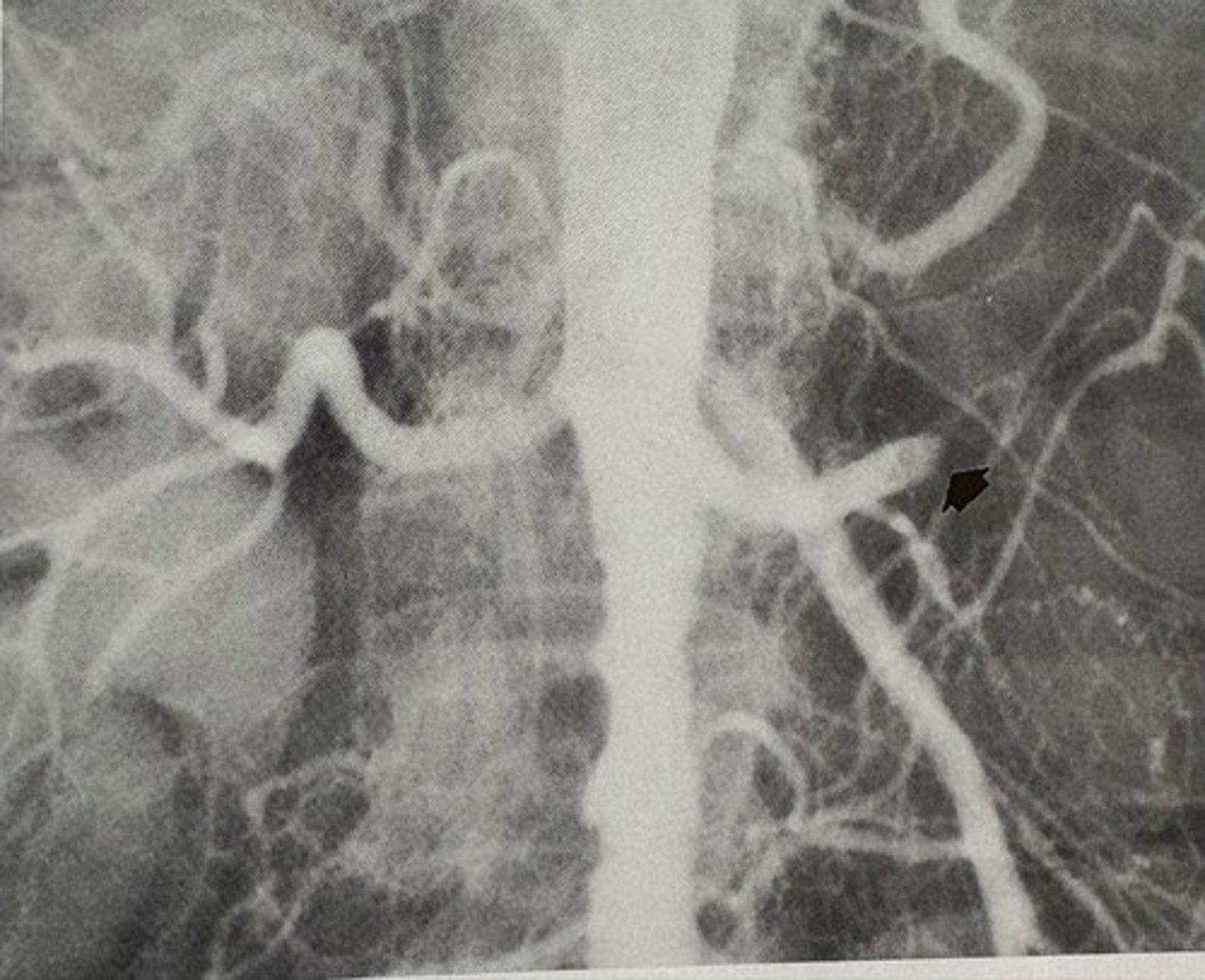 <p>what pathology is present?</p>