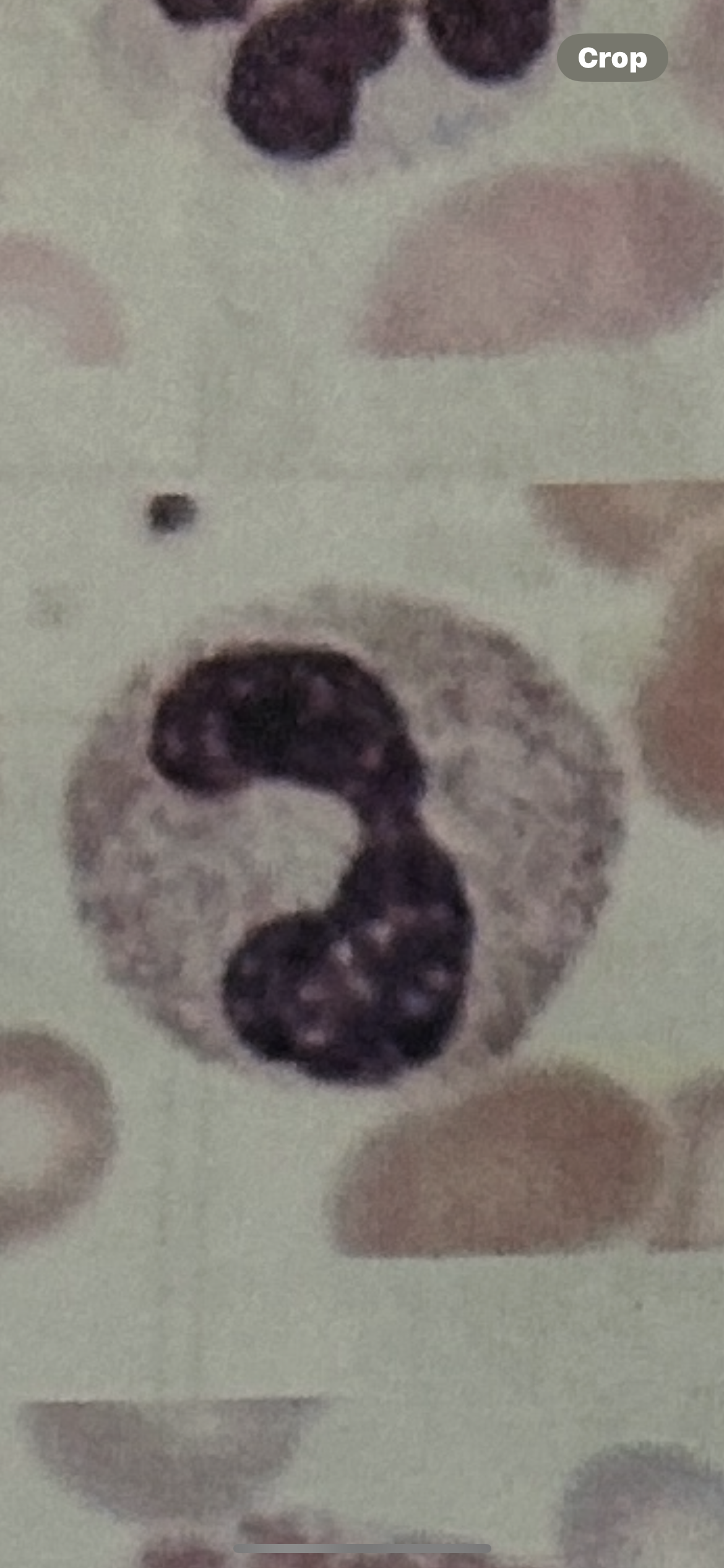 <p>WBC</p>