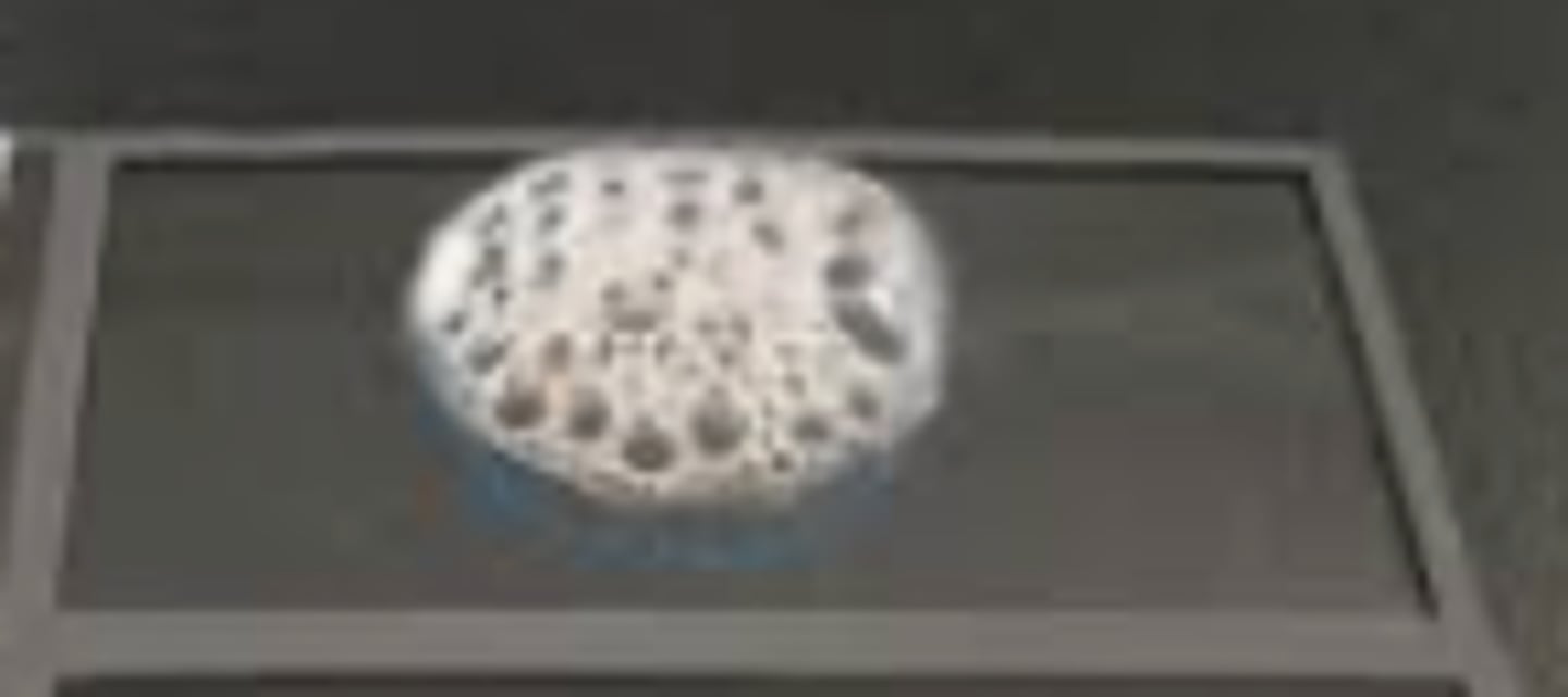 <p>A dog presented with pyoderma of the face and limbs. Material from pustules was plated on Blood (BA) and MacConkey (MAC) agars and incubated overnight at 350C. BA plates are provided. There was no growth on MAC.</p><p>Do a catalase test by adding a drop of the hydrogen peroxide reagent to a colony on a glass slide. Is it</p><p>catalase-positive or negative?</p>