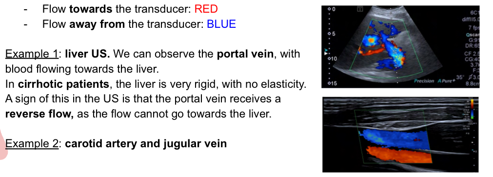 <p>Can be used to determine blood movement and when color is added to blood moving towards or away from transducer, the imaging can be helpful:</p>