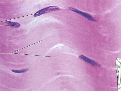 <p>Which of the three fibrous connective tissues is this a picture of?</p>