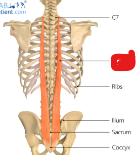 <p>Origin: whole length of posterior surface of transverse process + accessor process of lumbar vertebrae/lumbodorsal fascia</p><p>Insertions: (by rounded tendons) into the tips of the transverse processes of all the thoracic vertebrae, and by fleshy processes, into the lower 9-10 ribs between their tubercles and angles</p><p>Innervation: Dorsal primary rami of the thoracic and lumbar nerves</p><p>Action: extension/lateral flex of spine</p>