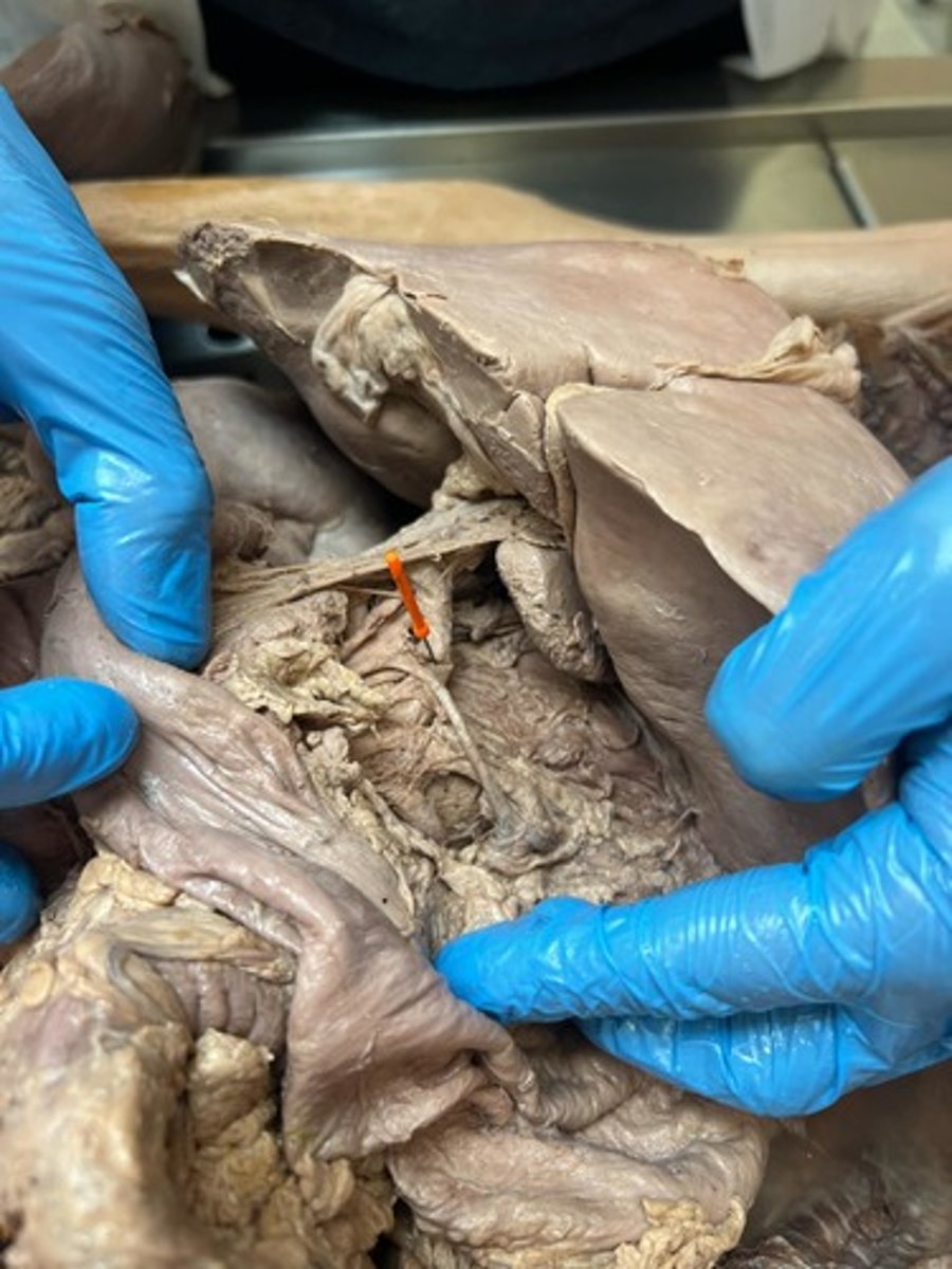 <p>common hepatic artery</p>