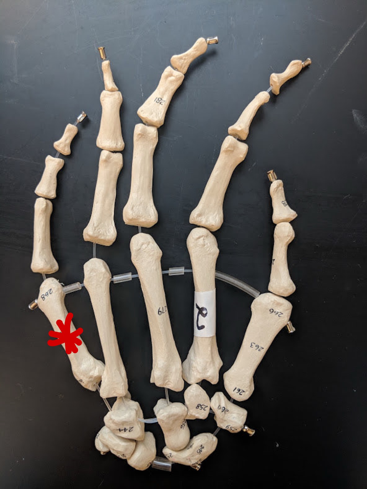 <p>Name this bone</p>