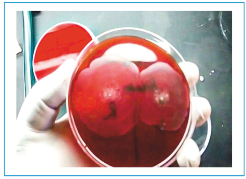 <p>• To determine strains in different patients.</p><p>• Same strains: Merging of swarming.</p><p>• Different strains: Line of demarcation.</p><p>• Known as Diene's Phenomenon.</p><p>• Should not be confused with Diene stain done for Mycoplasma.</p>