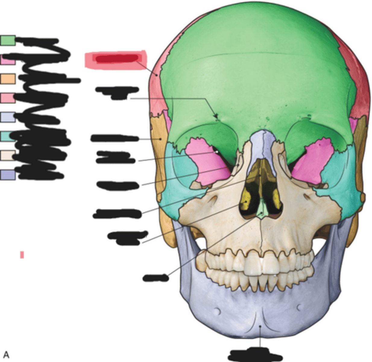 <p>Parietal bone</p>