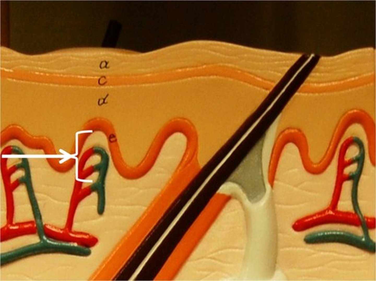 <p>what layer of the dermis is this</p>