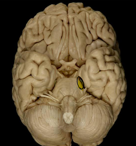 <p>List the nerve name, roman numeral, and function.</p>